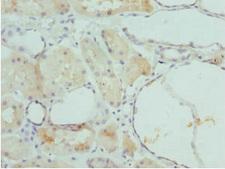 FBP1 Antibody - Immunohistochemistry of paraffin-embedded human kidney tissue at dilution 1:100