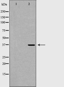 FBP1 Antibody - Western blot analysis of mouse kidney lysate using FBP1 antibody. The lane on the left is treated with the antigen-specific peptide.