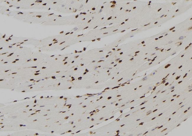 FBP1 Antibody - 1:100 staining mouse heart tissue by IHC-P. The sample was formaldehyde fixed and a heat mediated antigen retrieval step in citrate buffer was performed. The sample was then blocked and incubated with the antibody for 1.5 hours at 22°C. An HRP conjugated goat anti-rabbit antibody was used as the secondary.