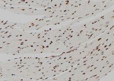 FBP1 Antibody - 1:100 staining mouse heart tissue by IHC-P. The sample was formaldehyde fixed and a heat mediated antigen retrieval step in citrate buffer was performed. The sample was then blocked and incubated with the antibody for 1.5 hours at 22°C. An HRP conjugated goat anti-rabbit antibody was used as the secondary.