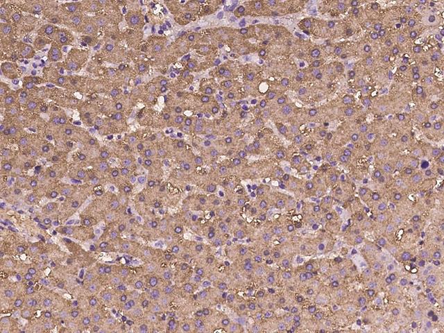 FBP1 Antibody - Immunochemical staining of human FBP1 in human liver with rabbit polyclonal antibody at 1:100 dilution, formalin-fixed paraffin embedded sections.