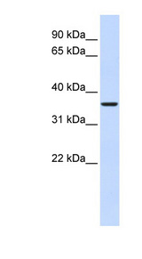 FBP2 Antibody - FBP2 antibody Western blot of Fetal Muscle lysate. This image was taken for the unconjugated form of this product. Other forms have not been tested.