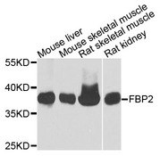 FBP2 Antibody - Western blot analysis of extracts of various cells.