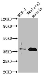 FBP2 Antibody - Western Blot Positive WB detected in: MCF-7 whole cell lysate, Rat skeletal muscle tissue All Lanes: FBP2 antibody at 3.5µg/ml Secondary Goat polyclonal to rabbit IgG at 1/50000 dilution Predicted band size: 37 KDa Observed band size: 37 KDa