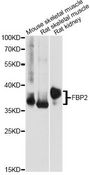 FBP2 Antibody - Western blot analysis of extracts of various cell lines, using FBP2 antibody at 1:1000 dilution. The secondary antibody used was an HRP Goat Anti-Rabbit IgG (H+L) at 1:10000 dilution. Lysates were loaded 25ug per lane and 3% nonfat dry milk in TBST was used for blocking. An ECL Kit was used for detection and the exposure time was 10s.