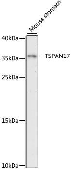 FBX23 / Tetraspanin 17 Antibody - Western blot analysis of extracts of mouse stomach, using TSPAN17 antibody at 1:1000 dilution. The secondary antibody used was an HRP Goat Anti-Rabbit IgG (H+L) at 1:10000 dilution. Lysates were loaded 25ug per lane and 3% nonfat dry milk in TBST was used for blocking. An ECL Kit was used for detection and the exposure time was 90s.