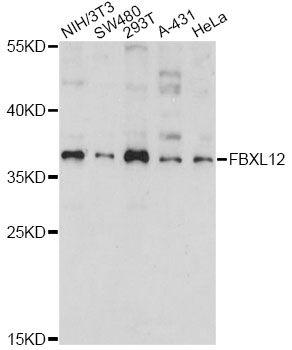 FBXL12 Antibody - Western blot analysis of extracts of various cell lines, using FBXL12 antibody at 1:1000 dilution. The secondary antibody used was an HRP Goat Anti-Rabbit IgG (H+L) at 1:10000 dilution. Lysates were loaded 25ug per lane and 3% nonfat dry milk in TBST was used for blocking. An ECL Kit was used for detection and the exposure time was 30s.
