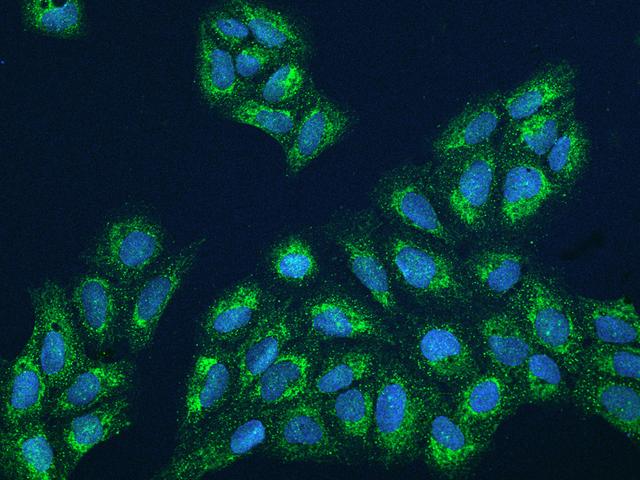 FBXL12 Antibody - Immunofluorescence staining of FBXL12 in U2OS cells. Cells were fixed with 4% PFA, permeabilzed with 0.3% Triton X-100 in PBS, blocked with 10% serum, and incubated with rabbit anti-Human FBXL12 polyclonal antibody (dilution ratio 1:200) at 4°C overnight. Then cells were stained with the Alexa Fluor 488-conjugated Goat Anti-rabbit IgG secondary antibody (green) and counterstained with DAPI (blue). Positive staining was localized to Cytoplasm.