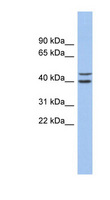 FBXL14 Antibody - FBXL14 antibody Western blot of Fetal Stomach lysate. This image was taken for the unconjugated form of this product. Other forms have not been tested.