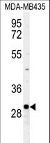 FBXL15 Antibody - Western blot of FBXL15 Antibody (RB26324) in MDA-MB435 cell line lysates (35 ug/lane). FBXL15 (arrow) was detected using the purified antibody.