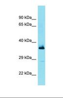 FBXL15 Antibody - Western blot of Fetal Lung. FBXL15 antibody dilution 1.0 ug/ml.  This image was taken for the unconjugated form of this product. Other forms have not been tested.
