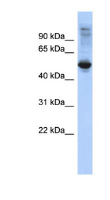 FBXL16 Antibody - FBXL16 antibody Western blot of HeLa lysate. This image was taken for the unconjugated form of this product. Other forms have not been tested.