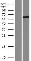 FBXL16 Protein - Western validation with an anti-DDK antibody * L: Control HEK293 lysate R: Over-expression lysate
