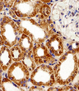 FBXL17 Antibody - Immunohistochemical of paraffin-embedded H. kidney section using FBXL17 Isoform 2 Antibody. Antibody was diluted at 1:100 dilution. A peroxidase-conjugated goat anti-rabbit IgG at 1:400 dilution was used as the secondary antibody, followed by DAB staining.