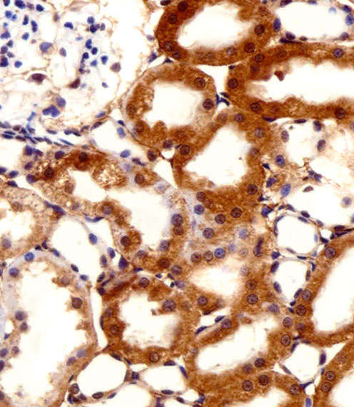 FBXL17 Antibody - Immunohistochemical of paraffin-embedded R. kidney section using FBXL17 Isoform 2 Antibody. Antibody was diluted at 1:100 dilution. A peroxidase-conjugated goat anti-rabbit IgG at 1:400 dilution was used as the secondary antibody, followed by DAB staining.