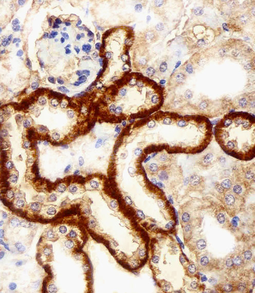 FBXL17 Antibody - Immunohistochemical of paraffin-embedded M. kidney section using FBXL17 Isoform 2 Antibody. Antibody was diluted at 1:100 dilution. A peroxidase-conjugated goat anti-rabbit IgG at 1:400 dilution was used as the secondary antibody, followed by DAB staining.