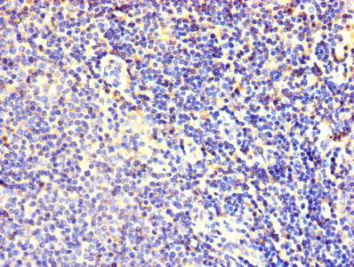 FBXL18 Antibody - Immunohistochemistry of paraffin-embedded human lymphoid tissue using FBXL18 Antibody at dilution of 1:100