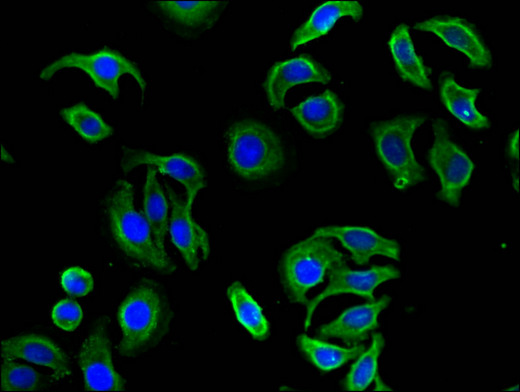 FBXL19 Antibody - Immunofluorescent analysis of A549 cells using FBXL19 Antibody at a dilution of 1:100 and Alexa Fluor 488-congugated AffiniPure Goat Anti-Rabbit IgG(H+L)