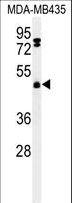 FBXL2 Antibody - Western blot of FBXL2 Antibody in MDA-MB435 cell line lysates (35 ug/lane). FBXL2 (arrow) was detected using the purified antibody.