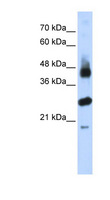 FBXL2 Antibody - FBXL2 antibody Western blot of Transfected 293T cell lysate. This image was taken for the unconjugated form of this product. Other forms have not been tested.