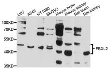 FBXL2 Antibody - Western blot analysis of extracts of various cell lines, using FBXL2 antibody at 1:1000 dilution. The secondary antibody used was an HRP Goat Anti-Rabbit IgG (H+L) at 1:10000 dilution. Lysates were loaded 25ug per lane and 3% nonfat dry milk in TBST was used for blocking. An ECL Kit was used for detection and the exposure time was 30s.