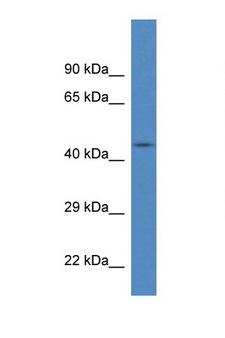 FBXL20 Antibody - FBXL20 antibody Western blot of Fetal Brain lysate. Antibody concentration 1 ug/ml.  This image was taken for the unconjugated form of this product. Other forms have not been tested.