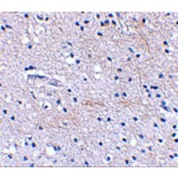 FBXL20 Antibody - Immunohistochemical staining of human brain tissue using Scrapper antibody at 2.5 µg/mL.