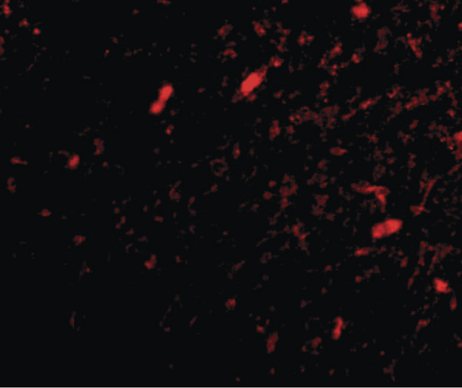 FBXL20 Antibody - Immunofluorescence of scrapper in human brain tissue with scrapper antibody at 20 ug/ml.