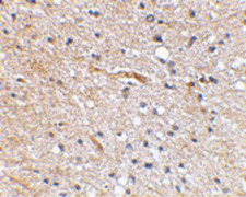 FBXL20 Antibody - Immunohistochemical staining of human brain tissue using Scrapper antibody at 2.5 ug/ml.