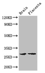FBXL22 Antibody - Positive WB detected in:Mouse brain tissue,Human placenta tissue;All lanes: FBXL22 antibody at 3ug/ml;Secondary;Goat polyclonal to rabbit IgG at 1/50000 dilution;Predicted band size: 28 kDa;Observed band size: 28 kDa;