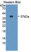 FBXL3 Antibody - Western blot of FBXL3 antibody.