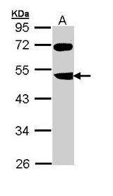 FBXL3 Antibody - Sample (30 ug of whole cell lysate). A: Molt-4 . 10% SDS PAGE. FBXL3 antibody diluted at 1:1000.
