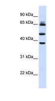 FBXL3 Antibody - FBXL3 antibody Western blot of Fetal Liver lysate. This image was taken for the unconjugated form of this product. Other forms have not been tested.