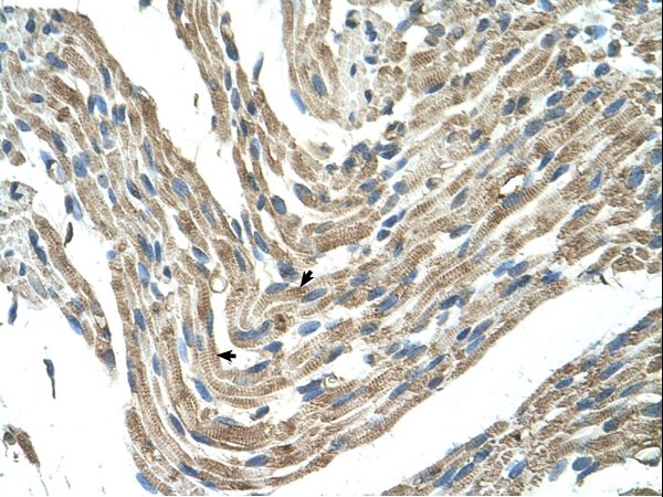 FBXL5 / FBL5 Antibody - FBXL5 antibody ARP43104_T100-NP_036293-FBXL5(F-box and leucine-rich repeat protein 5) Antibody was used in IHC to stain formalin-fixed, paraffin-embedded human muscle.  This image was taken for the unconjugated form of this product. Other forms have not been tested.