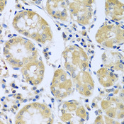 FBXL5 / FBL5 Antibody - Immunohistochemistry of paraffin-embedded human stomach tissue.