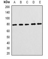 FBXL5 / FBL5 Antibody - Western blot analysis of FBL5 expression in HEK293T (A); mouse brain (B); mouse lung (C); rat testis (D); rat lung (E) whole cell lysates.