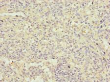 FBXL5 / FBL5 Antibody - Immunohistochemistry of paraffin-embedded human spleen tissue at dilution of 1:100