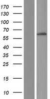 FBXL6 Protein - Western validation with an anti-DDK antibody * L: Control HEK293 lysate R: Over-expression lysate