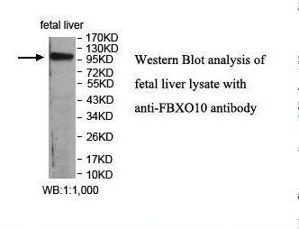 FBXO10 Antibody