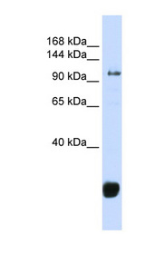FBXO10 Antibody - FBXO10 antibody Western blot of Jurkat lysate. This image was taken for the unconjugated form of this product. Other forms have not been tested.