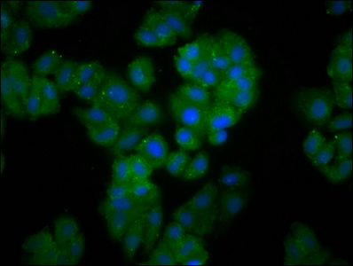 FBXO10 Antibody - Immunofluorescence staining of HepG2 cells diluted at 1:166, counter-stained with DAPI. The cells were fixed in 4% formaldehyde, permeabilized using 0.2% Triton X-100 and blocked in 10% normal Goat Serum. The cells were then incubated with the antibody overnight at 4°C.The Secondary antibody was Alexa Fluor 488-congugated AffiniPure Goat Anti-Rabbit IgG (H+L).