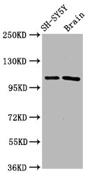 FBXO10 Antibody - Western Blot Positive WB detected in: SH-SY5Y whole cell lysate, Rat brain tissue All lanes: FBXO10 antibody at 4.8µg/ml Secondary Goat polyclonal to rabbit IgG at 1/50000 dilution Predicted band size: 106, 53 kDa Observed band size: 106 kDa