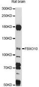 FBXO10 Antibody - Western blot analysis of extracts of rat brain, using FBXO10 antibody at 1:1000 dilution. The secondary antibody used was an HRP Goat Anti-Rabbit IgG (H+L) at 1:10000 dilution. Lysates were loaded 25ug per lane and 3% nonfat dry milk in TBST was used for blocking. An ECL Kit was used for detection and the exposure time was 90s.