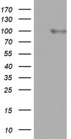 FBXO11 Antibody - HEK293T cells were transfected with the pCMV6-ENTRY control (Left lane) or pCMV6-ENTRY FBXO11 (Right lane) cDNA for 48 hrs and lysed. Equivalent amounts of cell lysates (5 ug per lane) were separated by SDS-PAGE and immunoblotted with anti-FBXO11.
