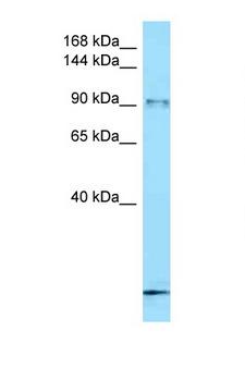 FBXO11 Antibody - FBXO11 antibody Western blot of Small Intestine lysate. Antibody concentration 1 ug/ml.  This image was taken for the unconjugated form of this product. Other forms have not been tested.