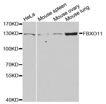 FBXO11 Antibody - Western blot analysis of extracts of various cell lines.