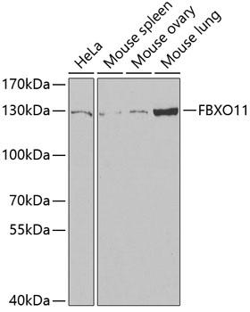 FBXO11 Antibody - Western blot analysis of extracts of various cell lines using FBXO11 Polyclonal Antibody at dilution of 1:1000.