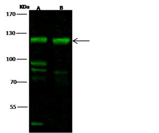 FBXO11 Antibody - Anti-FBXO11 rabbit polyclonal antibody at 1:500 dilution. Lane A: 293T Whole Cell Lysate. Lane B: HeLa Whole Cell Lysate. Lysates/proteins at 30 ug per lane. Secondary: Goat Anti-Rabbit IgG H&L (Dylight 800) at 1/10000 dilution. Developed using the Odyssey technique. Performed under reducing conditions. Predicted band size: 94 kDa. Observed band size: 120 kDa. (We are unsure as to the identity of these extra bands.)