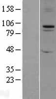 FBXO11 Protein - Western validation with an anti-DDK antibody * L: Control HEK293 lysate R: Over-expression lysate