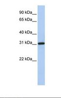 FBXO16 Antibody - Hela cell lysate. Antibody concentration: 1.0 ug/ml. Gel concentration: 12%.  This image was taken for the unconjugated form of this product. Other forms have not been tested.